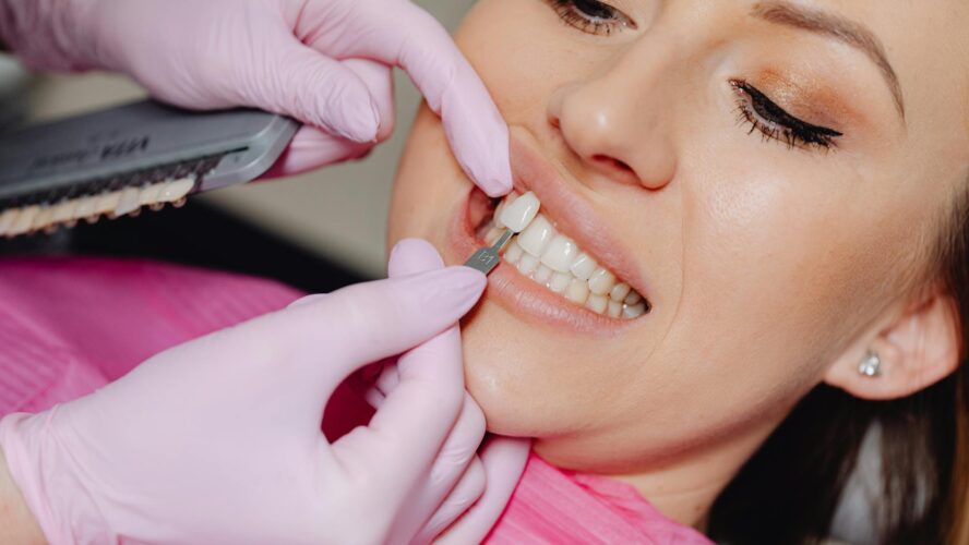 Common Myths About Dental Veneers Debunked