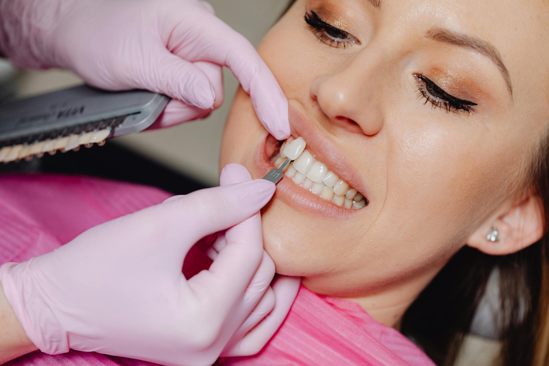 Common Myths About Dental Veneers Debunked