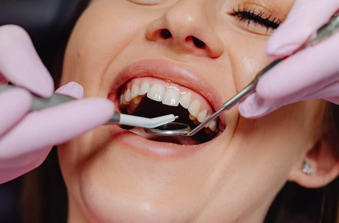 5 Signs You Might Need a Dental Bridge – And What to Do Next